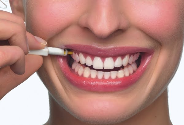 Implante Dentário Gratuito – Como Funciona