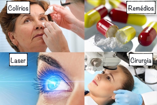 glaucoma tratamento